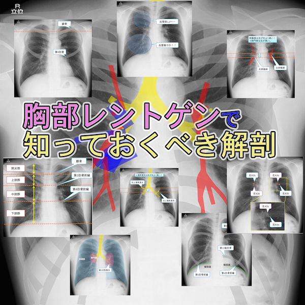 保存版】胸部レントゲンを読影する上で知っておくべき解剖